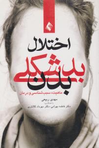 اختلال بدشکلی بدن